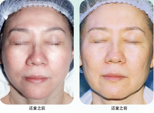 米乐|米乐·M6(中国游)官方网站