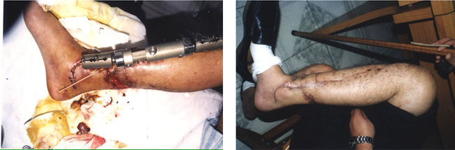 米乐|米乐·M6(中国游)官方网站