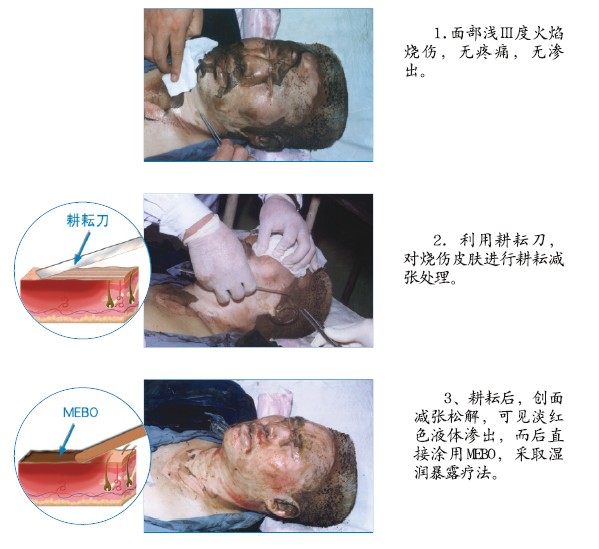 米乐|米乐·M6(中国游)官方网站