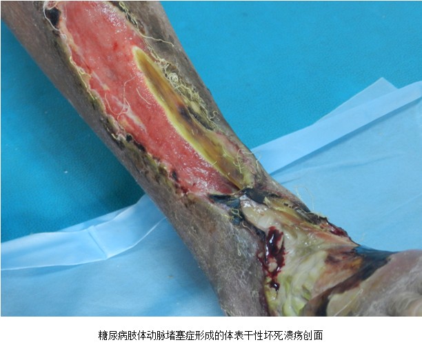 米乐|米乐·M6(中国游)官方网站